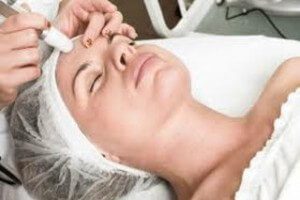 Medical-Microderm, Permanent Laser Hair Reduction in NJ | Anara Medspa