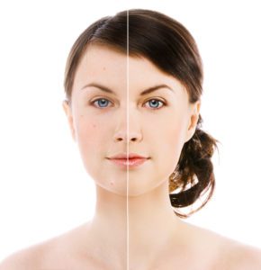 botox in nj