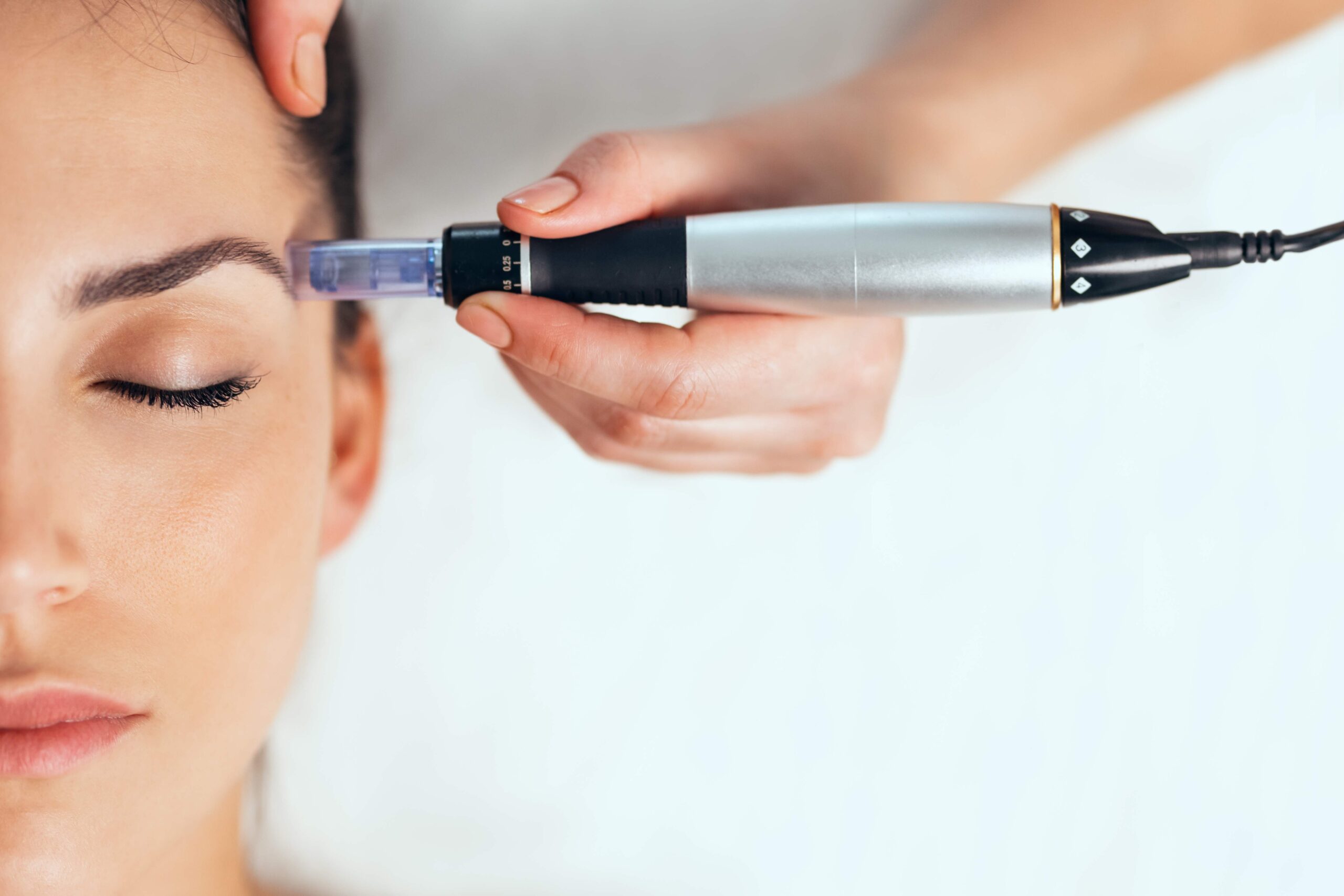 Microneedling in New Jersey