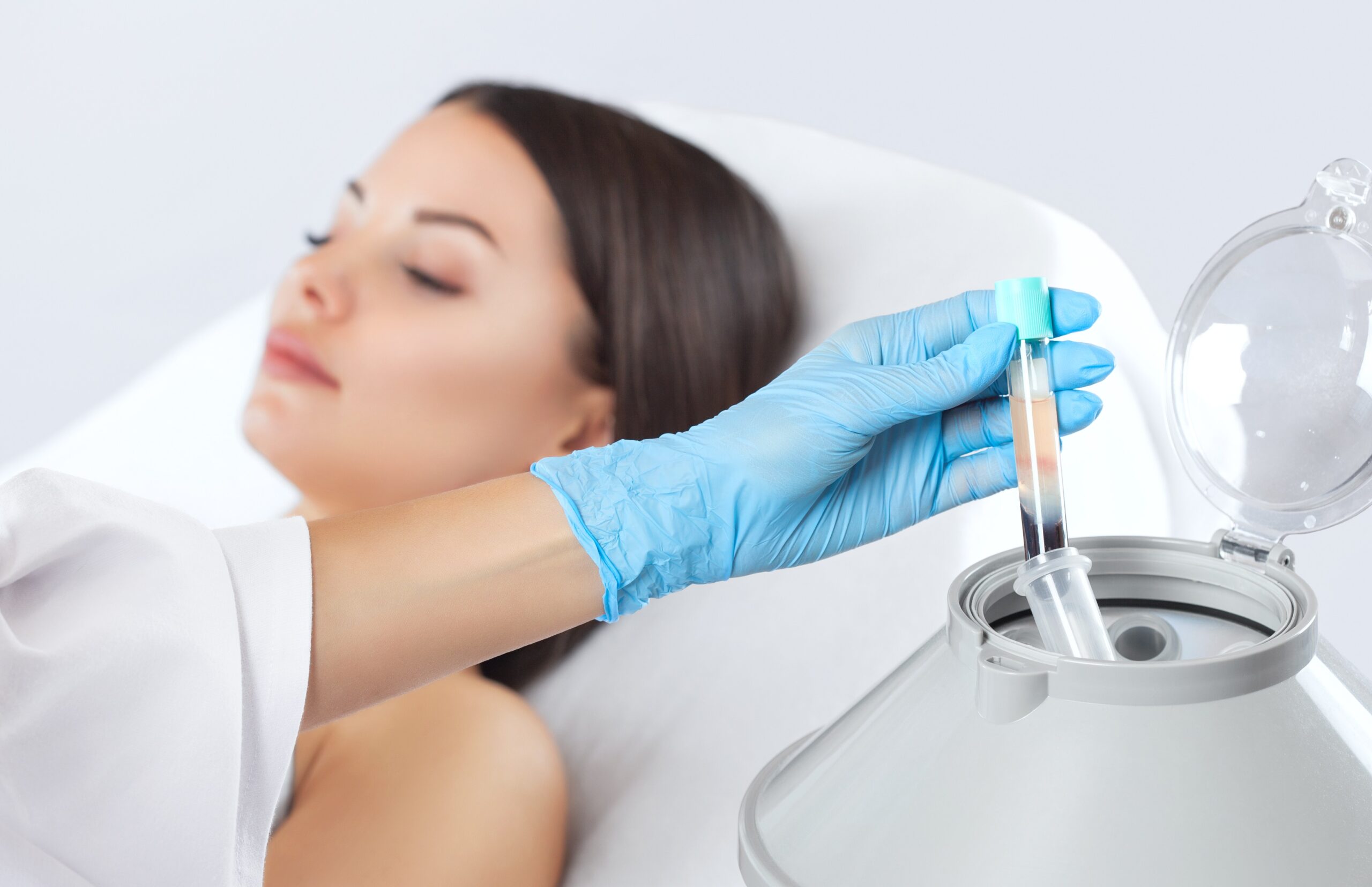 PRP Procedures NJ PRP Treatments NJ Anara Medspa NJ