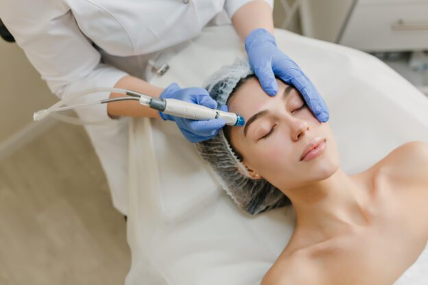 Microneedling Treatment