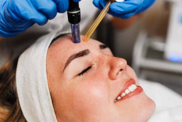 microneedling